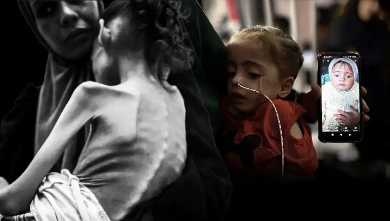 Türkiye'de Küçük Meryem'in Açlık Mücadelesi: Yalnızca 10 Kilo!